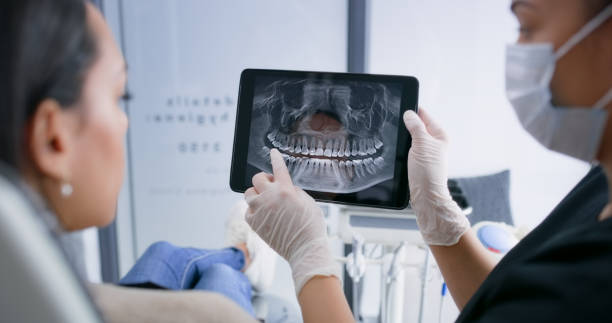 Licensed Tooth Extraction service in Shelton, WA - Smile Center Dentistry